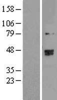 TRMT2B Human Over-expression Lysates NM_024917
