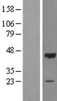 OBFC1 (STN1) Human Over-expression Lysates NM_024928