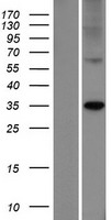 ELOVL7 Human Over-expression Lysates NM_024930
