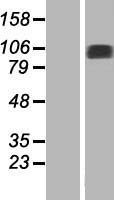 NAP1 (NAA25) Human Over-expression Lysates NM_024953