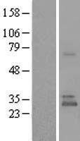 UBTD1 Human Over-expression Lysates NM_024954