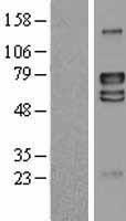 ls080059 lrrtm4 human over expression lysates nm 024993 wb testing 2