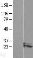 ARL14 Human Over-expression Lysates NM_025047