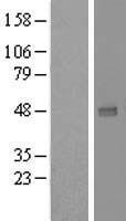 UXS 1 (UXS1) Human Over-expression Lysates NM_025076