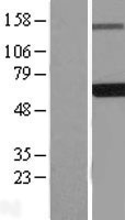 EDC3 Human Over-expression Lysates NM_001142444