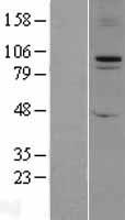 FBXO11 Human Over-expression Lysates NM_025133