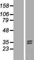 Nucleotide binding protein like (NUBPL) Human Over-expression Lysates NM_025152
