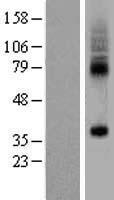 SLC35F5 Human Over-expression Lysates NM_025181