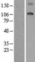 SCUBE1 Human Over-expression Lysates NM_173050