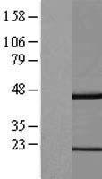 ls080318 gkap1 human over expression lysates nm 025211 wb testing 1