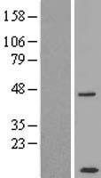 CCDC68 Human Over-expression Lysates NM_001143829