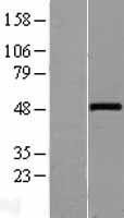 WNT10A Human Over-expression Lysates NM_025216