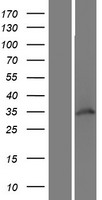 WDR82 Human Over-expression Lysates NM_025222
