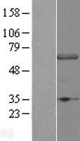 WDR23 (DCAF11) Human Over-expression Lysates NM_025230