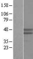 RNF39 Human Over-expression Lysates NM_025236