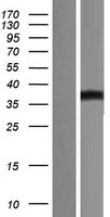 B7H3 (CD276) Human Over-expression Lysates NM_025240