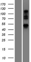 UBXN6 Human Over-expression Lysates NM_025241