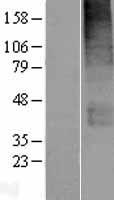 SLC19A3 Human Over-expression Lysates NM_025243