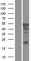 PBX4 Human Over-expression Lysates NM_025245
