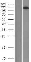 KIAA1688 (ARHGAP39) Human Over-expression Lysates NM_025251