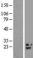 B9D2 Human Over-expression Lysates NM_030578