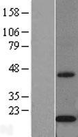Cytochrome b5 Outer Mitochondrial Membrane (CYB5B) Human Over-expression Lysates NM_030579