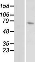 DUSP16 Human Over-expression Lysates NM_030640