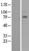 TAS1R1 Human Over-expression Lysates NM_177540