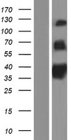 TAS1R1 Human Over-expression Lysates NM_177541