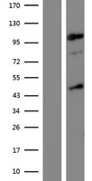 ls080853 jhdm1d kdm7a human over expression lysates nm 030647 wb testing 1