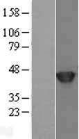 SETD7 Human Over-expression Lysates NM_030648