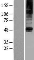 PTDSS2 Human Over-expression Lysates NM_030783