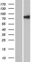 RSPH6A Human Over-expression Lysates NM_030785