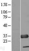 ls081542 txndc tmx1 human over expression lysates nm 030755 wb testing 1