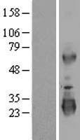 LRRC3 Human Over-expression Lysates NM_030891