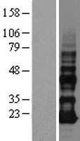 ls081552 vopp1 human over expression lysates nm 030796 wb testing 1