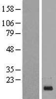 C1orf21 Human Over-expression Lysates NM_030806