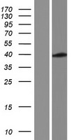 NIPA2 Human Over-expression Lysates NM_001184888