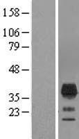 TMEM163 Human Over-expression Lysates NM_030923