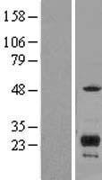 ITM2C Human Over-expression Lysates NM_001012514