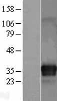 ITM2C Human Over-expression Lysates NM_030926