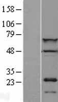 CDT1 Human Over-expression Lysates NM_030928