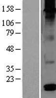 DEFB126 Human Over-expression Lysates NM_030931