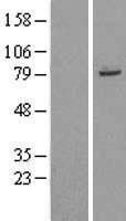 TRIM56 Human Over-expression Lysates NM_030961