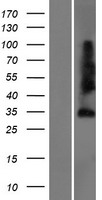 Sprouty 4 (SPRY4) Human Over-expression Lysates NM_030964