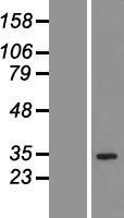 QTRT1 Human Over-expression Lysates NM_031209
