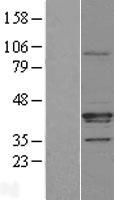 FAM108A1 (ABHD17A) Human Over-expression Lysates NM_031213