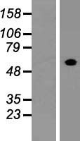 FCRL4 Human Over-expression Lysates NM_031282