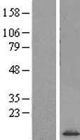 SF3B5 Human Over-expression Lysates NM_031287