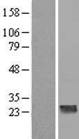 ls083446 ccdc70 human over expression lysates nm 031290 wb testing 1